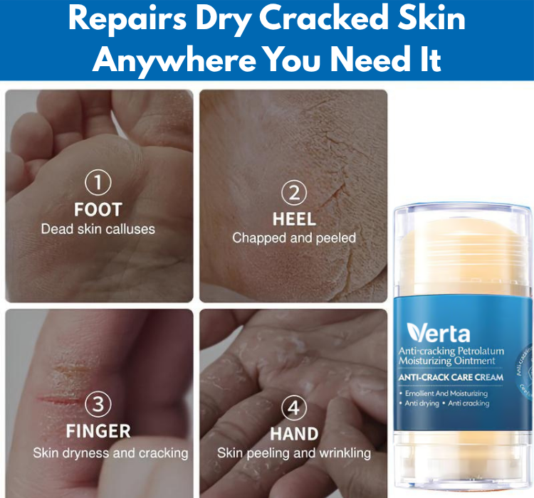Verta® Anti Cracked Foot Balm