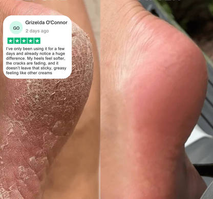 Verta® Anti Cracked Foot Balm