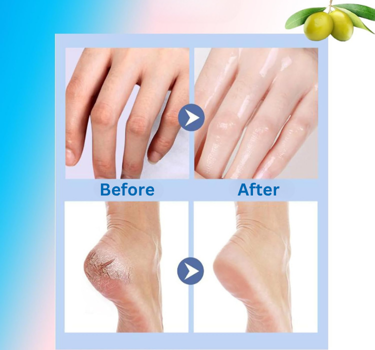 Verta® Anti Cracked Foot Balm