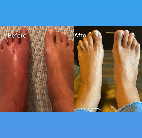 Verta™ EMS Foot Massager