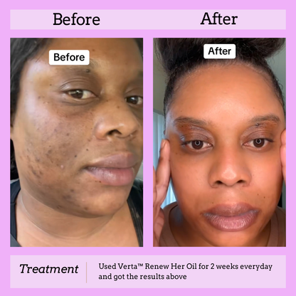 Verta™ Renew Her Oil